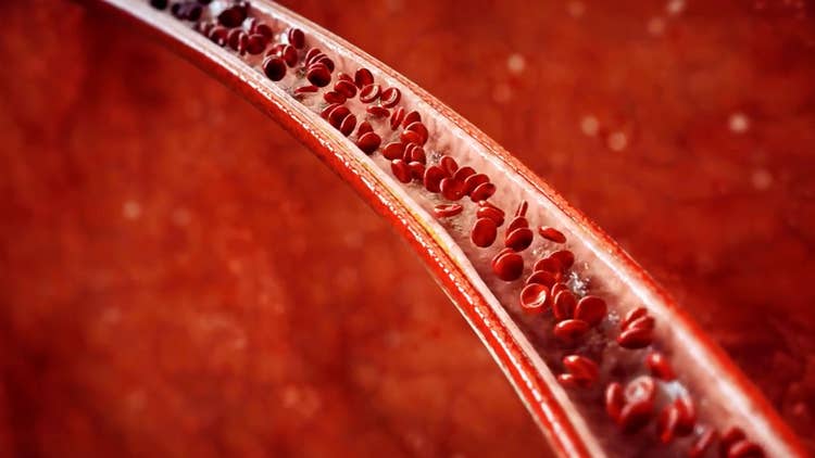 Blood cells in arteries
